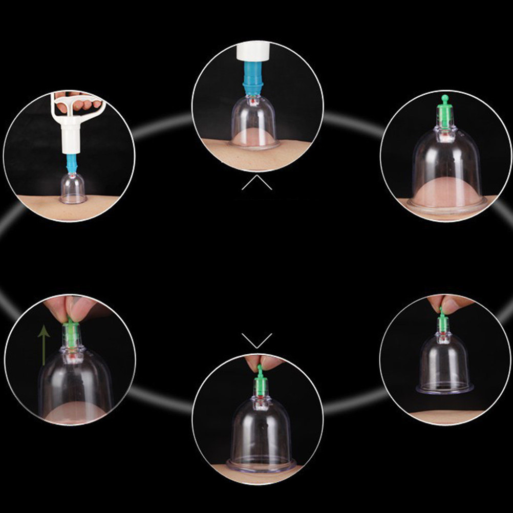 24 Vacuum Cupping Cups Kit Hom - Home Improvement In review and price